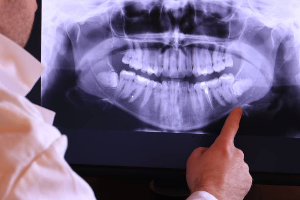 Best Emergency Dental Care for Sports Injuries in Fairbury, NE