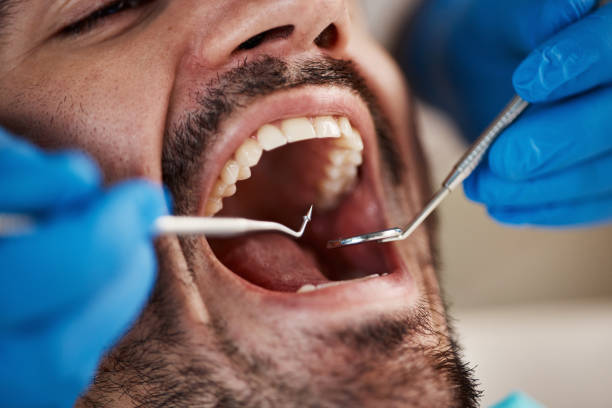 Best Walk-In Emergency Dental Services in Fairbury, NE