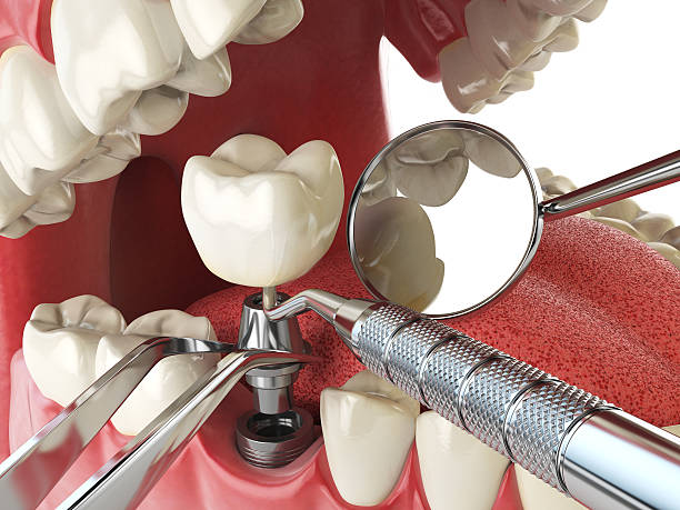 Best Walk-In Emergency Dental Services in Fairbury, NE